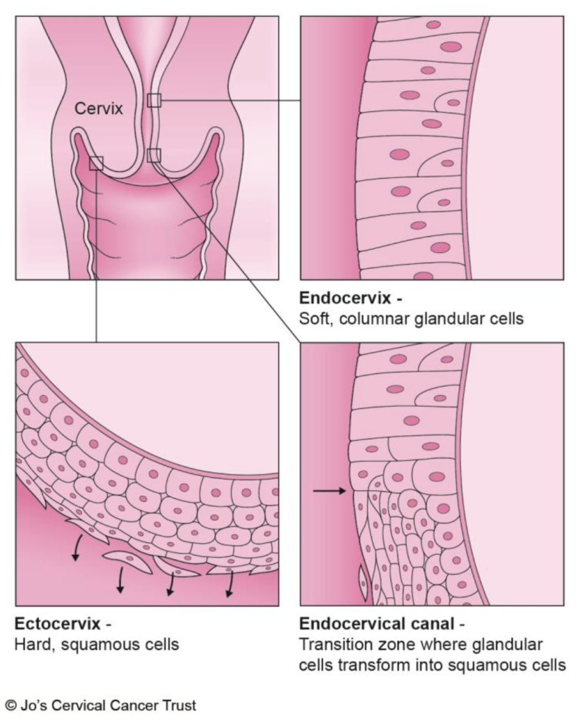 four images show detail of cervical structure